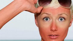 أمراض جلدية يجلبها الصيف معه..؟!