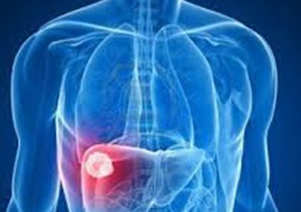 دراسة تحذر: مرضى السكر يواجهون خطر أمراض الكبد الدهني