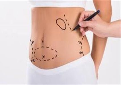 بريطانيا..ارتداء الملابس الرياضية وراء زيادة عمليات شفط الدهون