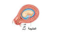 الخلايا الجذعية المأخوذة من مشيمة الأمهات يمكنها علاج ضرر النوبات