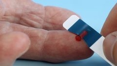 ما أسباب أمراض الكبد المميتة؟