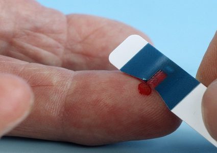 ما أسباب أمراض الكبد المميتة؟