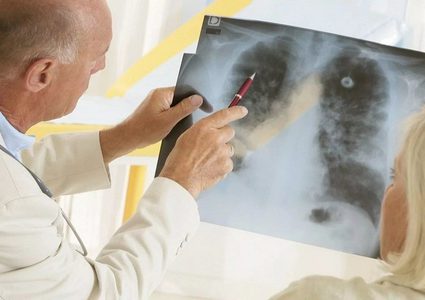 الذكاء الاصطناعي التابع لـ "غوغل" يتفوق على الأطباء بكشف السرطان