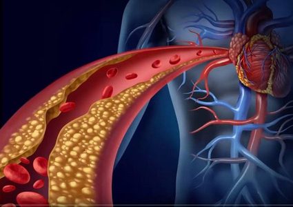 ابتكار دعامات فريدة للأوعية الدموية