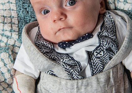 ولد بدون جلد..رضيع يتحدى توقعات الأطباء ويعيش حتى عمر 6 أشهر