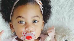 دراسة: الأطفال ذوي البشرة السمراء أكثر عرضة للأكزيما المزمنة