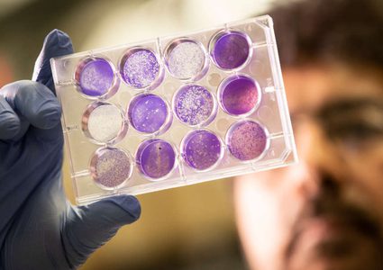 الباحثون يطورون طريقة جديدة لتخزين اللقاحات دون الحاجة للتبريد