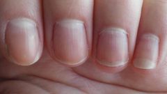 النساء أكثر عرضة لتشقق الأظافر من الرجال