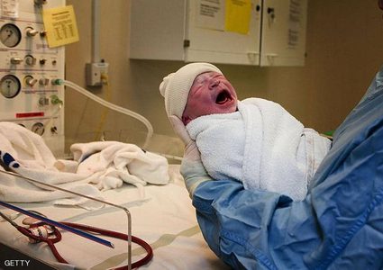 ولادة أصغر رضيعة في العالم