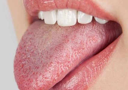 تعرفوا على أبرز 4 أسباب لجفاف الفم