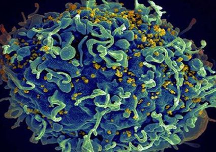 كم من الوقت يمكن أن يعيش فيروس نقص المناعة على الأسطح ؟