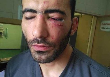 مسلسل الاعتداء على الكوادر الطبية مستمر في الخليل