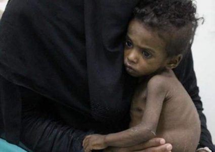 الاتحاد الإفريقي: 91 مليون شخص يمرضون سنويا بالطعام الملوث