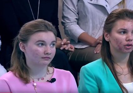 أسباب ظهور حب الشباب بعد الثلاثين من العمر