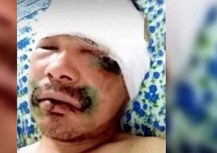 رجل قطع لسان دب لينجو منه