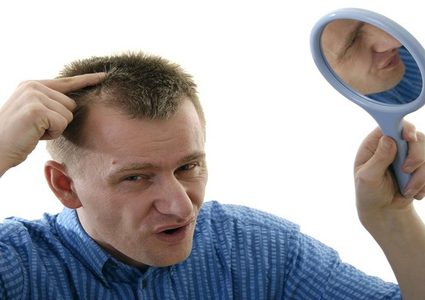 القهوة لمكافحة الصلع