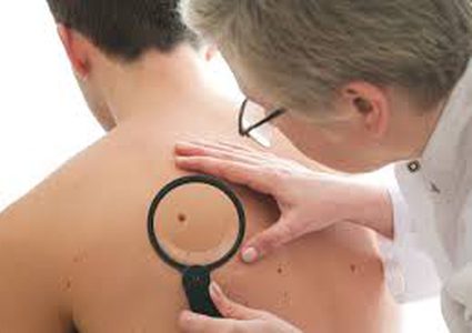 ضوء ليزر للكشف عن سرطان الجلد خلال 10 ثواني