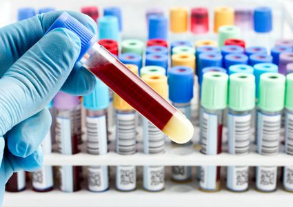 اكتشاف علمي قد ينقذ آلاف الأرواح