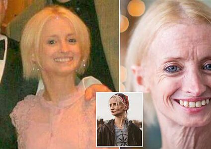 بالصور: أميركية 'تسبق عمرها' بـ8 مرات.. والسبب نادر!