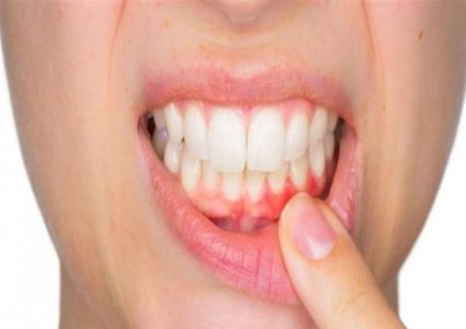 دراسة : العلاقة بين مشاكل اللثة وخطر الإصابة بسرطان الكبد