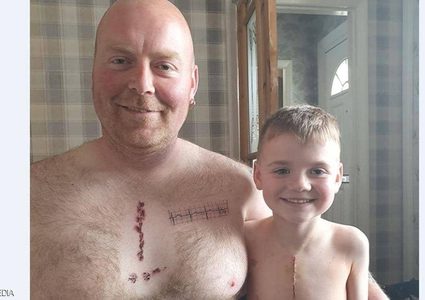 أب يرسم "وشم الغرز الجراحية" تعاطفا مع ابنه المريض