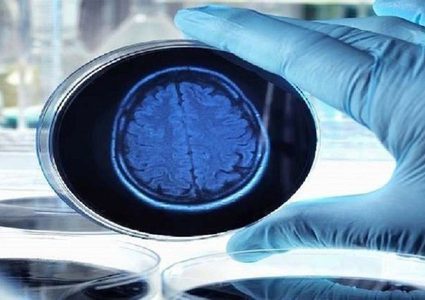 اكتشاف جديد يعطي أملا لعلاج الأعراض المبكرة لمرض ألزهايمر