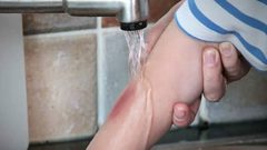 5 طرق طبيعية لعلاج الحروق البسيطة في المنزل