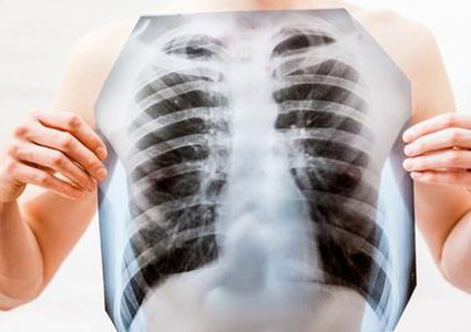 نظافة الأيدي والأسنان والمنزل تساعد في الحفاظ على صحة الرئة