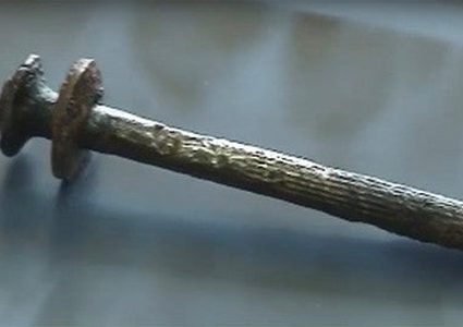 روسي يصدم بوجود مسمار في جمجمته بعد معاناته من صعوبة في السمع!