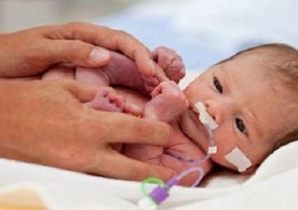 دراسة: الولادة المبكرة تؤثر سلبا على صحة دماغ الطفل