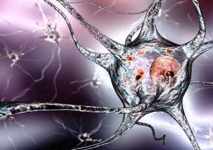 هل يبدأ مرض باركينسون في القناة الهضمية؟