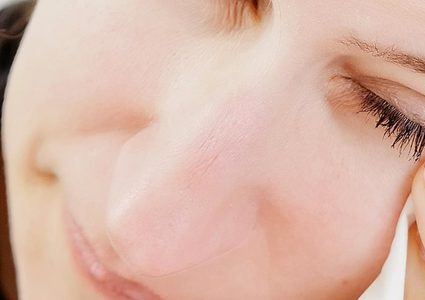 ‫ما هي إنفلونزا العيون؟‬