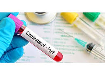 تحذير..انخفاض الكولسترول يرفع خطر الإصابة بالسكتة الدماغية