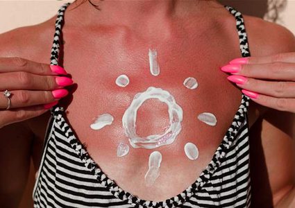 تصابين بالحروق رغم إستخدام واقي الشمس؟ نقدم لك هذه الحلول