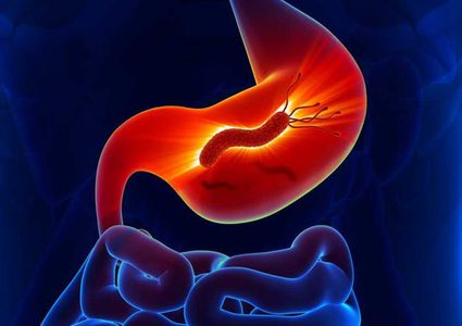 ما هي جرثومة المعدة "الهيلكوباكتر بايلوري" ؟