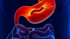 ما هي جرثومة المعدة "الهيلكوباكتر بايلوري" ؟