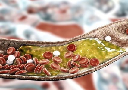 دراسة تكشف خطر "انخفاض" الكوليسترول!