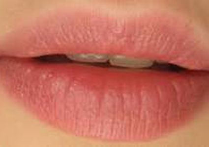 لنفخ الشفاه بطريقة طبيعية