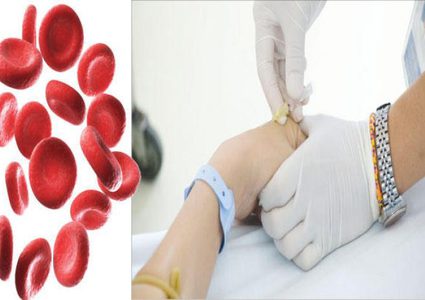 الحديد الزائد في الجسم يؤدي إلى أمراض جلدية خطيرة