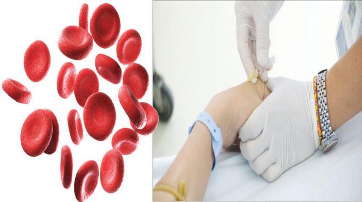 الحديد الزائد في الجسم يؤدي إلى أمراض جلدية خطيرة