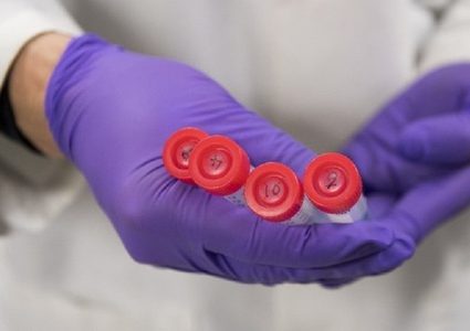 اختبار "التنصت على محادثات البكتيريا"