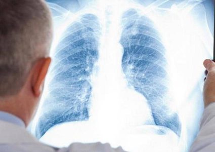 علماء صينيون يتوصلون لـ"علاج محتمل" لسرطان الرئة