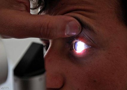 "اصفرار العين".. مؤشر بسيط على أمراض خطيرة