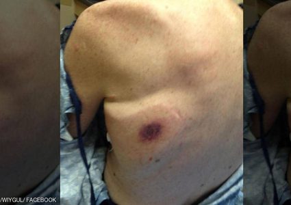 بكتيريا تقتل رجلا بعد 48 ساعة من نزوله إلى الماء