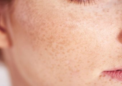 أشياء مفاجئة قد تؤثر على بشرتك دون أن تدركها