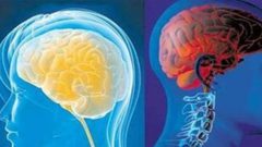 رقاقات في أدمغة الناس لعلاجهم