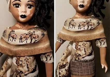 دمى مميزة لدعم الأطفال المصابين بالبهاق نفسيا