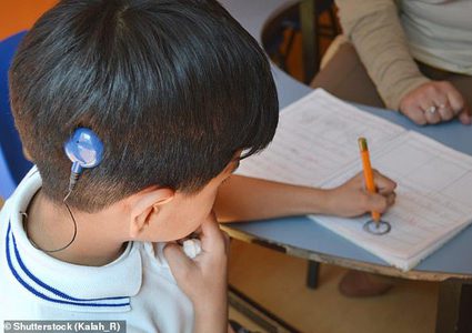 قوقعة صناعية جديدة تعمل على تحسين جودة الصوت لدى الصم