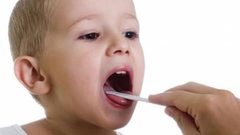 استئصال اللوزتين لدى الأطفال