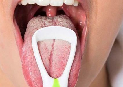 ماهي أسباب المعاناة من التهاب الحنجرة ؟